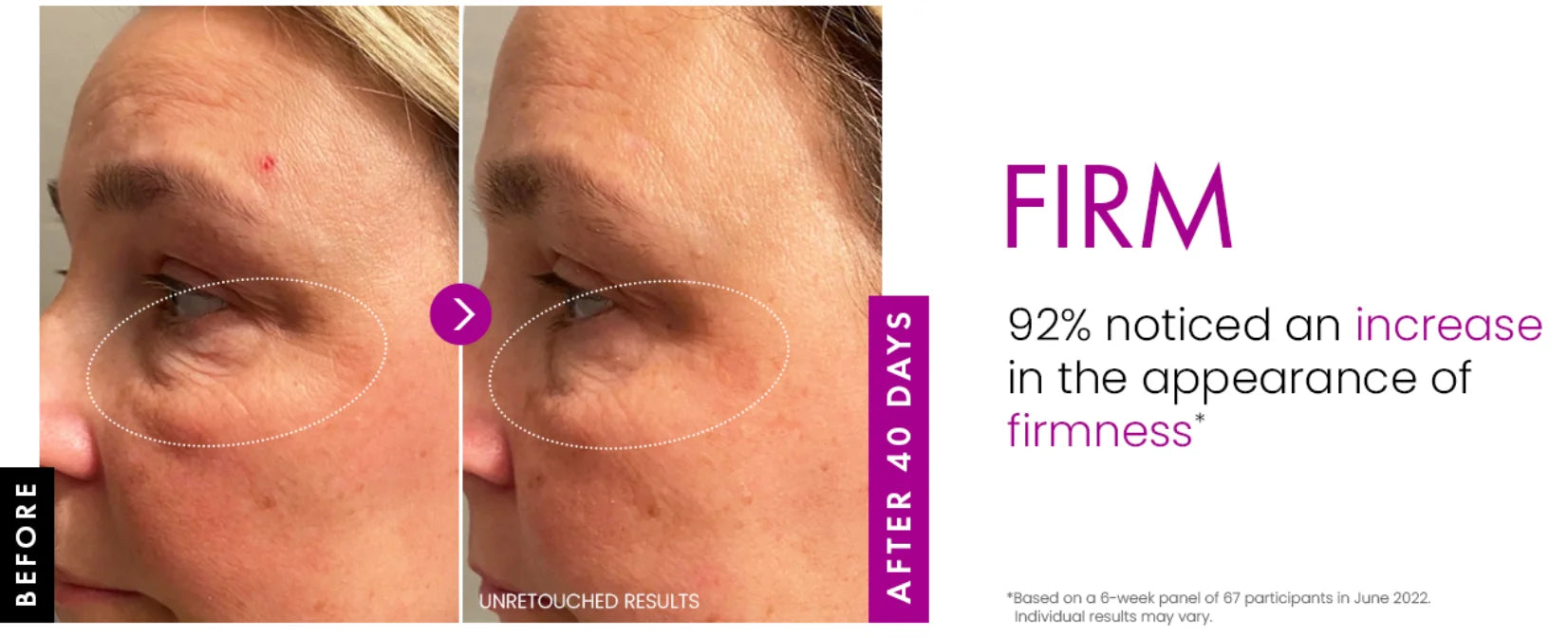 Collagen Face Cream - Nourish Plump Up Skin