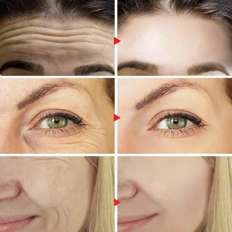 Retinol Wrinkle Remover Face Serum