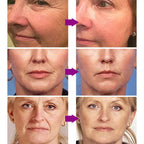 Retinol Wrinkle Remover Face Serum