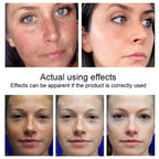 Kojic Acid Serum Korean Skin Care