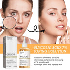 Glycolic Acid 7% Toning Solution Ordinary Acne Remover