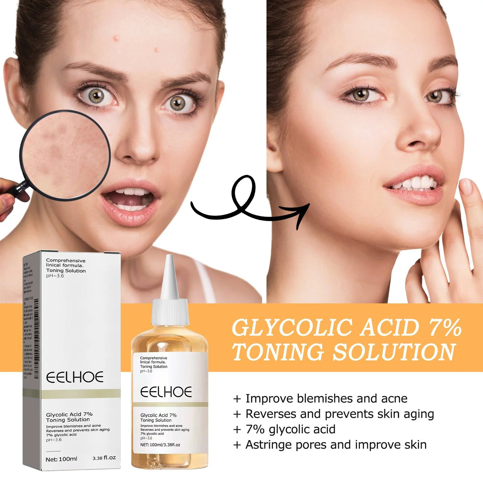 Glycolic Acid 7% Toning Solution Ordinary Acne Remover