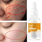 Kojic Acid Serum Korean Skin Care