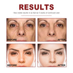 Retinol Wrinkle Remover Face Serum