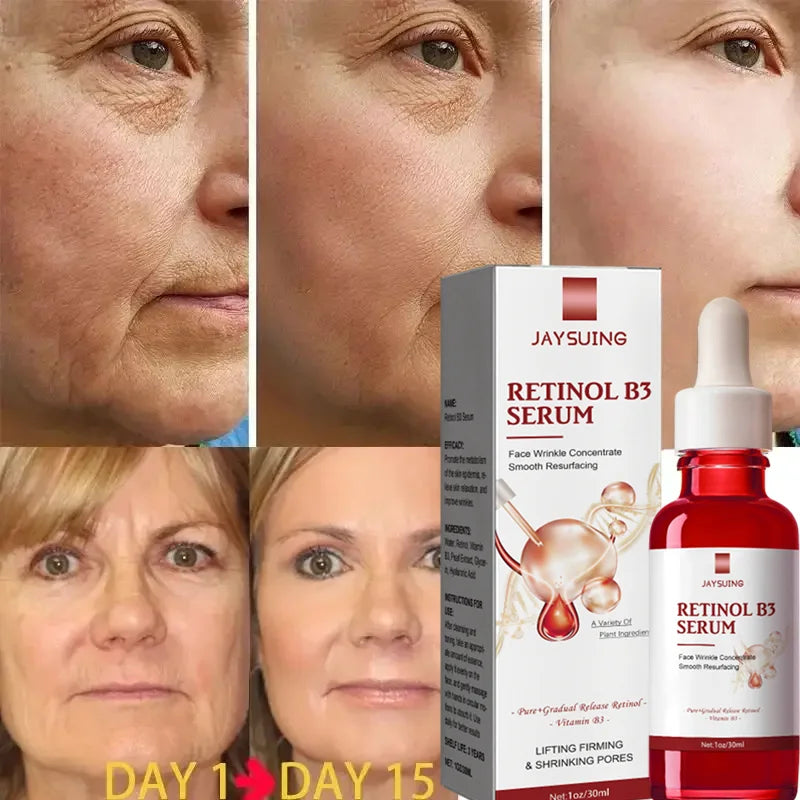 Retinol Wrinkle Remover Face Serum