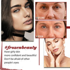 Retinol Wrinkle Remover Face Serum