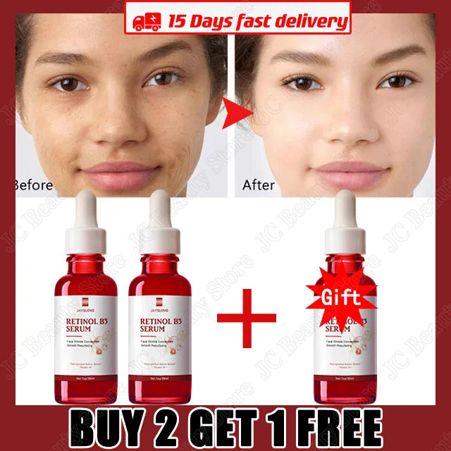 Retinol Wrinkle Remover Face Serum