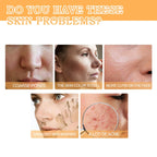 Glycolic Acid 7% Toning Solution Ordinary Acne Remover