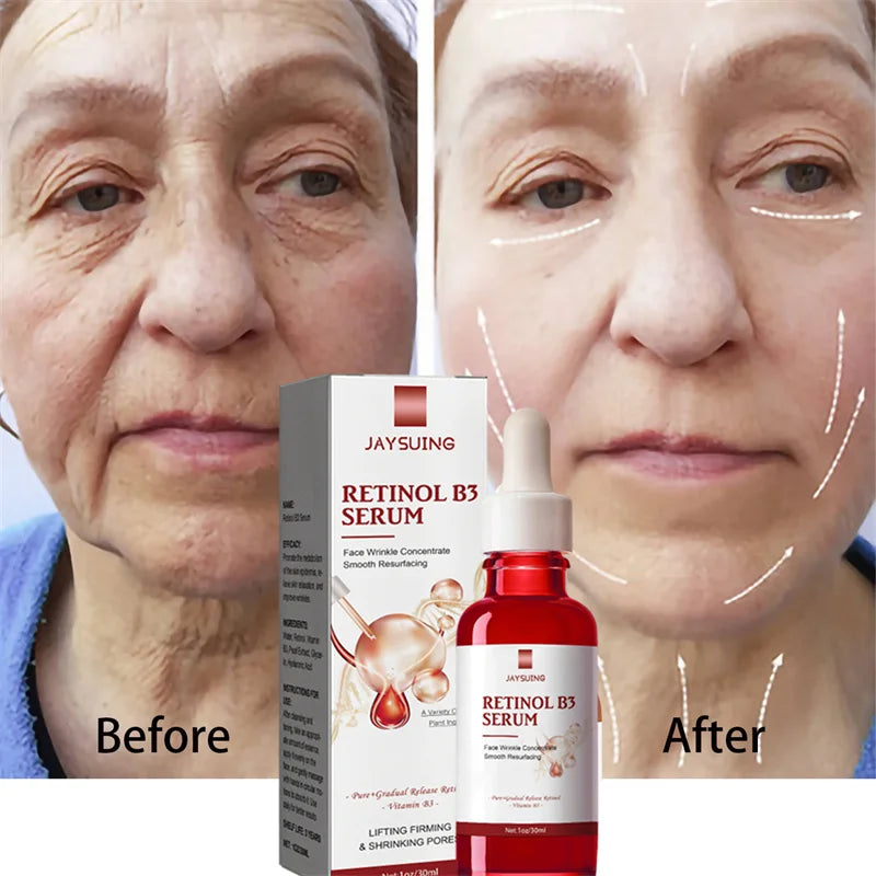 Retinol Wrinkle Remover Face Serum
