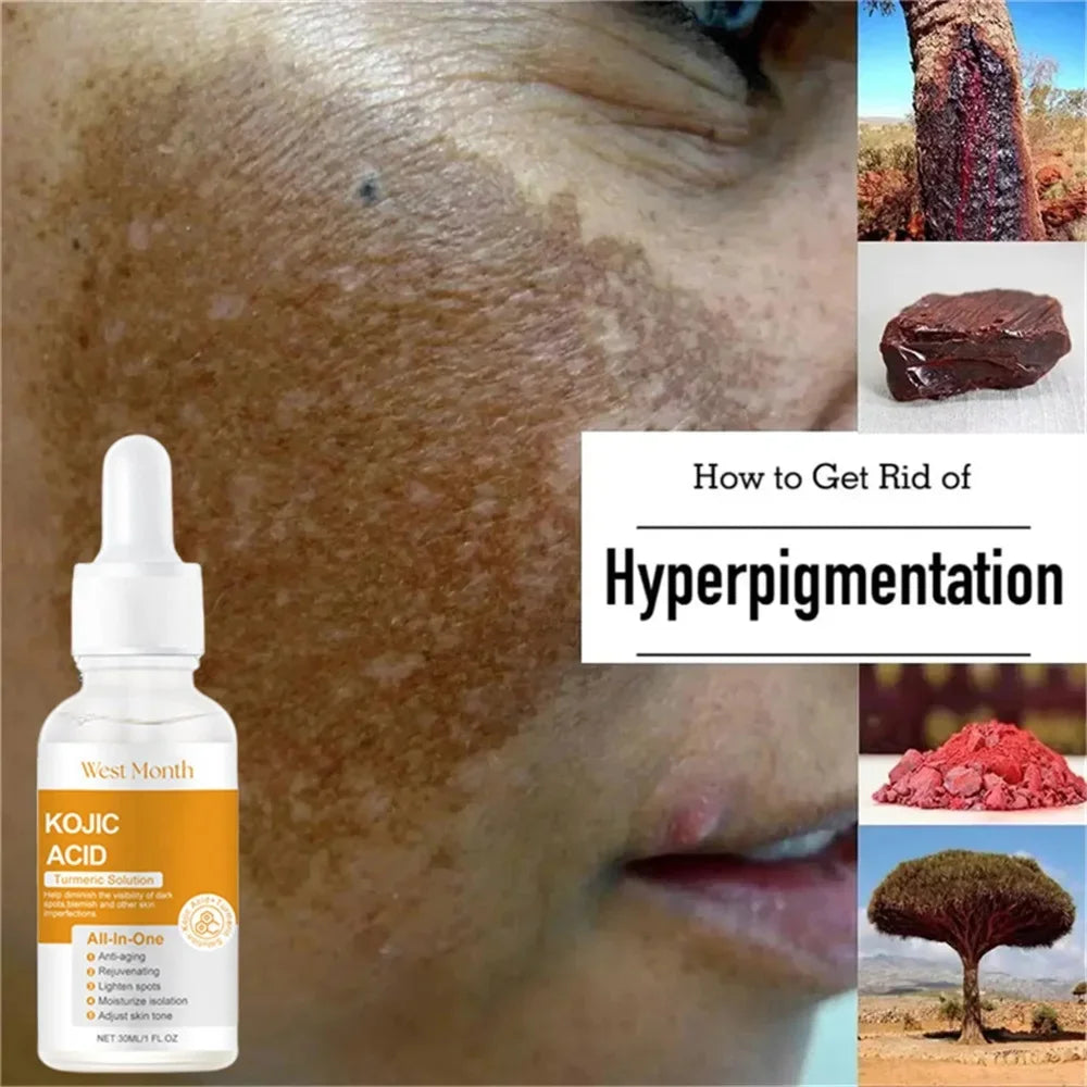 Kojic Acid Freckle Removing Whitening Essence Fade Pigmentation Melasma Dark Spots Corrector Repair Serum Korean Skin Care